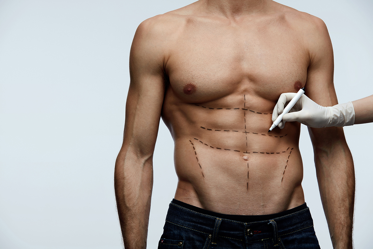 De beaux abdominaux avec l'abdominal etching - Lyon