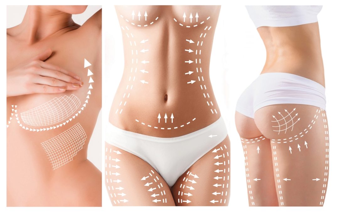 Plusieurs interventions de chirurgie esthétique à la fois : est-ce possible ?