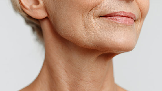 Comment enlever les bajoues naturellement